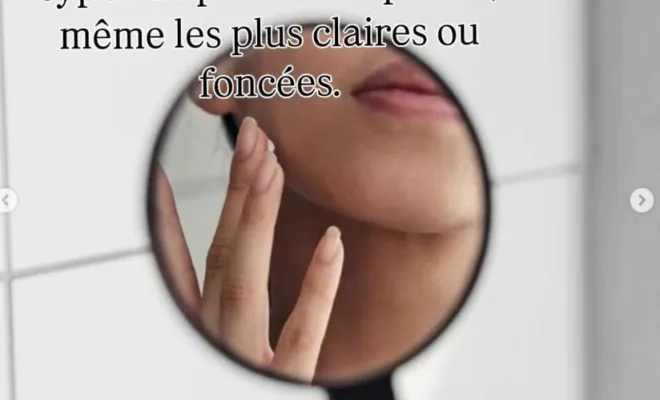 Séance d’électrolyse pour dire adieu aux poils à Chassieu, Chassieu, Emilie Valenciano - Eau'natur'elle