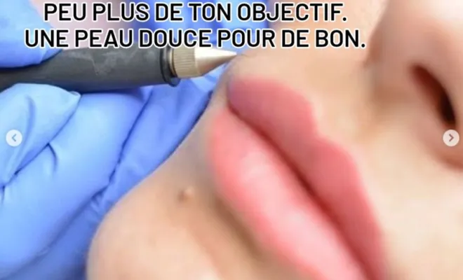 Séance d’électrolyse pour dire adieu aux poils à Chassieu, Chassieu, Emilie Valenciano - Eau'natur'elle