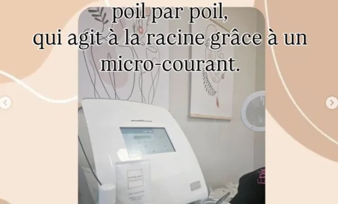 Séance d’électrolyse pour dire adieu aux poils à Chassieu, Chassieu, Emilie Valenciano - Eau'natur'elle